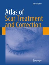 book Atlas of Scar Treatment and Correction