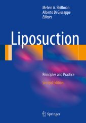 book Liposuction: Principles and Practice