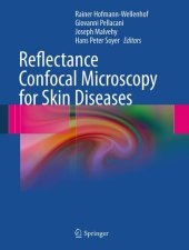 book Reflectance Confocal Microscopy for Skin Diseases