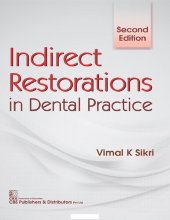 book Indirect Restorations