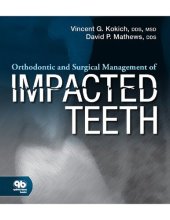 book Orthodontic and Surgical Management of Impacted Teeth