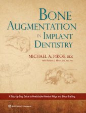 book Bone Augmentation in Implant Dentistry: A Step-By-Step Guide to Predictable Alveolar Ridge and Sinus Grafting