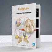 book Contouring posterior bridges