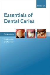 book Essentials of Dental Caries