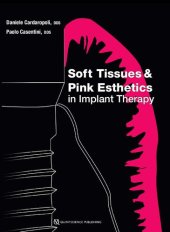 book Soft Tissues and Pink Esthetics in Implant Therapy