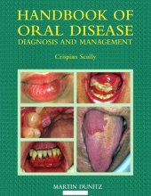 book Handbook of Oral Disease: Diagnosis and Management