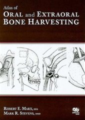 book Atlas of Oral and Extraoral Bone Harvesting