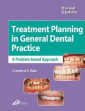 book Treatment Planning in General Dental Practice (Dental Update)