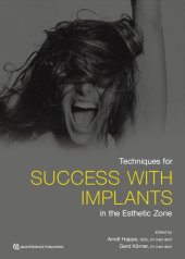 book Techniques for Success With Implants in the Esthetic Zone