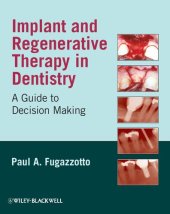 book Implant and Regenerative Therapy in Dentistry: A Guide to Decision Making