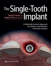 book Single-Tooth Implant