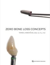 book Zero Bone Loss Concepts