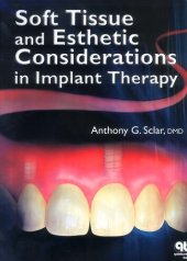 book Soft Tissue and Esthetic Considerations in Implant Therapy