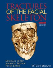 book Fractures of the Facial Skeleton