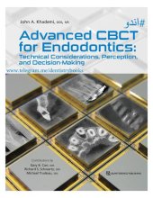 book Advanced CBCT for Endodontics. Technical Considerations, Perception, and Decision-Making by KDUR