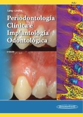 book Periodontología Clínica e Implantología Odontológica TOMO 1 y 2 by KADUR