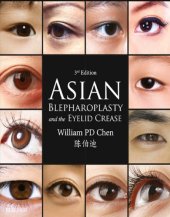 book Asian Blepharoplasty and the Eyelid Crease