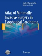 book Atlas of Minimally Invasive Surgery in Esophageal Carcinoma