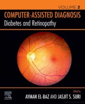 book Diabetes and Retinopathy: Computer-Assisted Diagnosis Volume 2