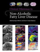 book Clinical Dilemmas in Non-Alcoholic Fatty Liver Disease