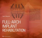 book Full-Arch Implant Rehabilitation