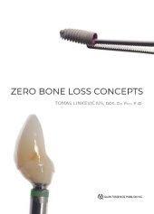 book Zero Bone Loss Concepts