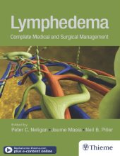 book Lymphedema: Complete Medical and Surgical Management