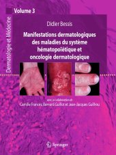 book Manifestations dermatologiques des maladies du système hématopoiétique et oncologique dermatologique