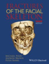 book Fractures of the Facial Skeleton