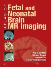 book Atlas of Fetal and Postnatal Brain MR