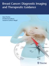 book Breast cancer : diagnostic imaging and therapeutic guidance