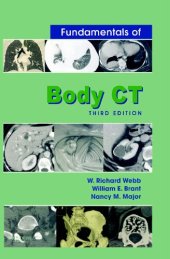 book Fundamentals of Body CT, 3e