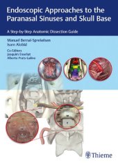 book Endoscopic approaches to the paranasal sinuses and skull base : a step-by-step anatomic dissection guide