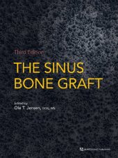 book The sinus bone graft