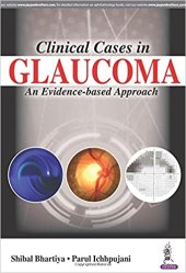 book Clinical Cases in Glaucoma: An Evidence Based Approach