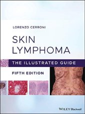 book Skin Lymphoma: The Illustrated Guide