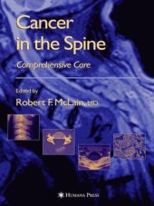 book Cancer in the Spine: Comprehensive Care