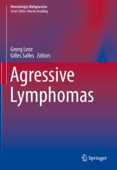 book Aggressive Lymphomas (Hematologic Malignancies)