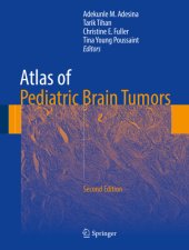 book Atlas of Pediatric Brain Tumors