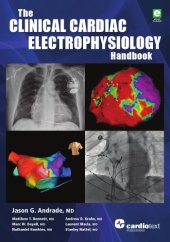 book Clinical cardiac electrophysiology handbook