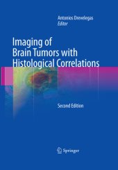 book Imaging of Brain Tumors with Histological Correlations