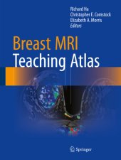 book Breast MRI Teaching Atlas