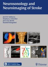 book Neurosonology and Neuroimaging of Stroke A Comprehensive Reference