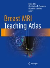 book Breast MRI teaching atlas