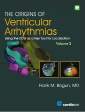 book The Origins of Ventricular Arrhythmias: Using the ECG as a Key Tool for Localization, Volume 2