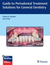 book Guide to Periodontal Treatment Solutions for General Dentistry