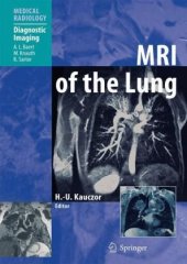 book MRI of the Lung