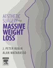 book Aesthetic Surgery After Massive Weight Loss