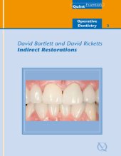 book Indirect Restorations: Quintessentials of Dental Practice Vol. 25