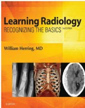 book Learning radiology: recognizing the basics